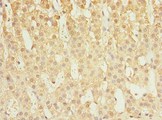 CAPNS1 Antibody