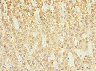 CAPNS1 antibody