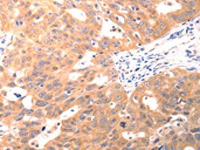 CAPNS1 Antibody