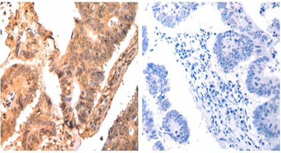 CAPNS1 Rabbit Polyclonal Antibody