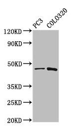 CAPS2 antibody