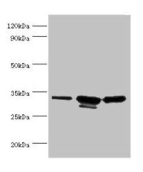 CAPZB Antibody
