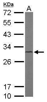 CAPZB antibody