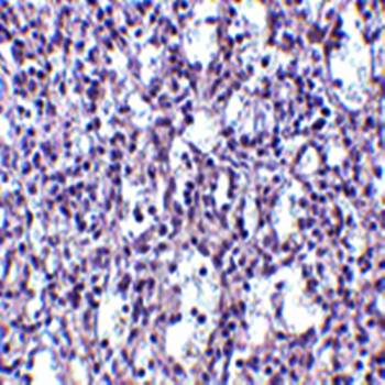 Carabin Antibody