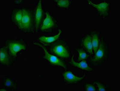 Carbonic anhydrase 1 antibody