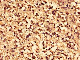 CA1 Antibody