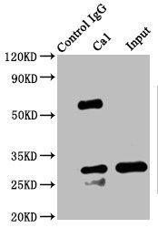 Carbonic anhydrase 1 antibody