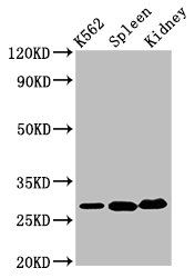 Carbonic anhydrase 1 antibody