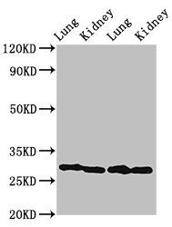 Carbonic anhydrase 1 antibody