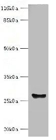 Carbonic anhydrase 1 antibody
