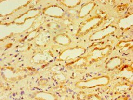 CA12 Antibody