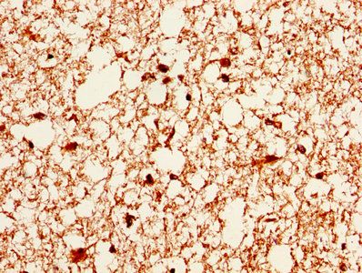 Carbonic anhydrase 2 antibody