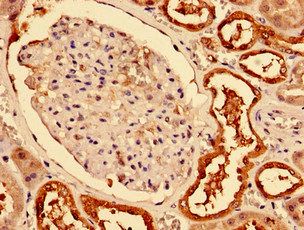 CA2 Antibody