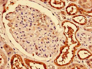 Carbonic anhydrase 2 antibody