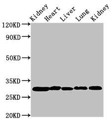 Carbonic anhydrase 2 antibody