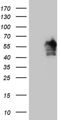 Carboxypeptidase M Antibody