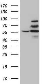 Carboxypeptidase M Antibody