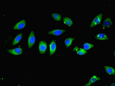CARD10 Antibody