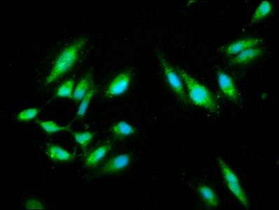 CARD14 Antibody