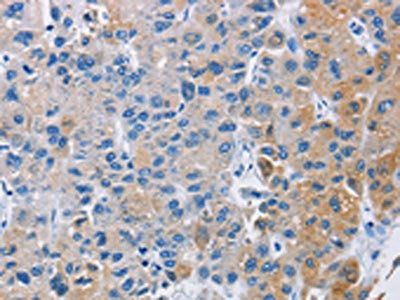 CARD14 Antibody