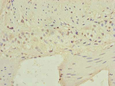 CARD19 Antibody