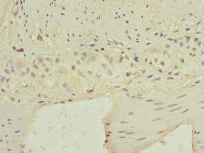 CARD19 antibody