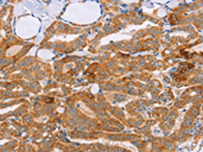 CARD6 Antibody