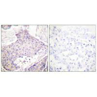 CARD6 antibody