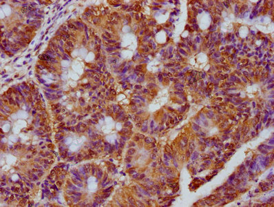 CARD6 Antibody