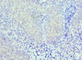 CARD8 Antibody