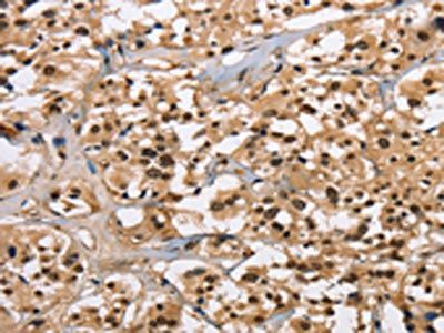CARD8 Antibody
