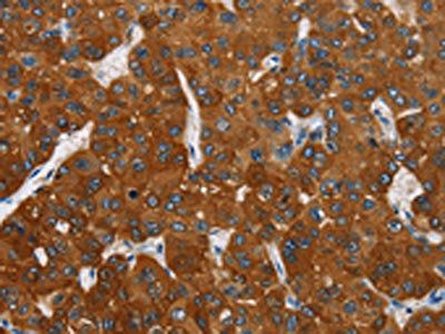 CARD9 Antibody