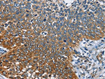 CARD9 Antibody