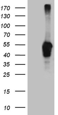 Cardiac Troponin T Antibody