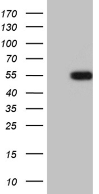 Cardiac Troponin T Antibody