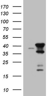 Cardiac Troponin T Antibody