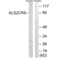 CARF antibody