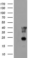 SHPK Antibody