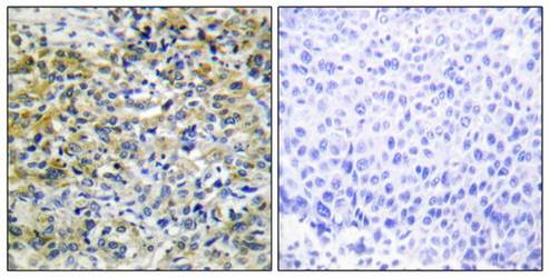 CARKL Antibody