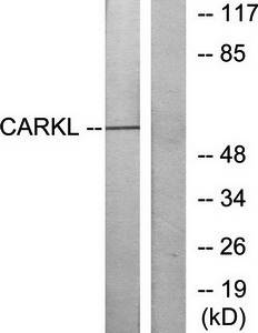 CARKL Antibody