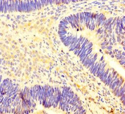 CARM1 Antibody