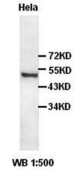CARM1 Rabbit Polyclonal Antibody