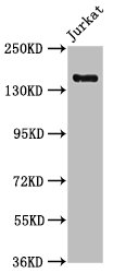 CARMIL2 Antibody