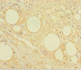 CASK Antibody