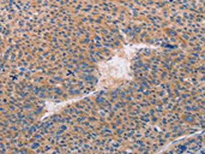 CASP10 Antibody