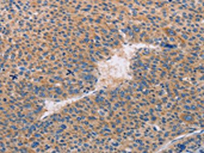 CASP10 antibody