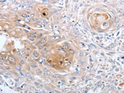 CASP12 Antibody