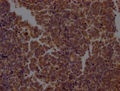 CASP2 Recombinant Monoclonal Antibody