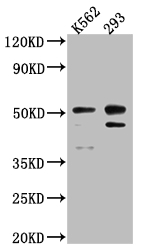CASP2 Recombinant Monoclonal Antibody
