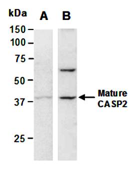 CASP2 (C) Antibody, Rabbit Polyclonal